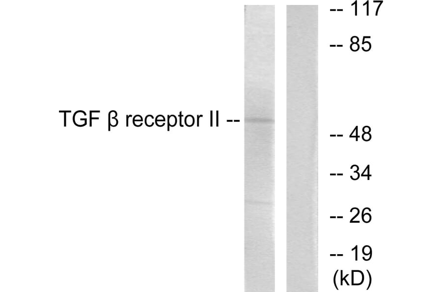 Western Blot - Anti-TGF beta Receptor II Antibody (C0338) - Antibodies.com