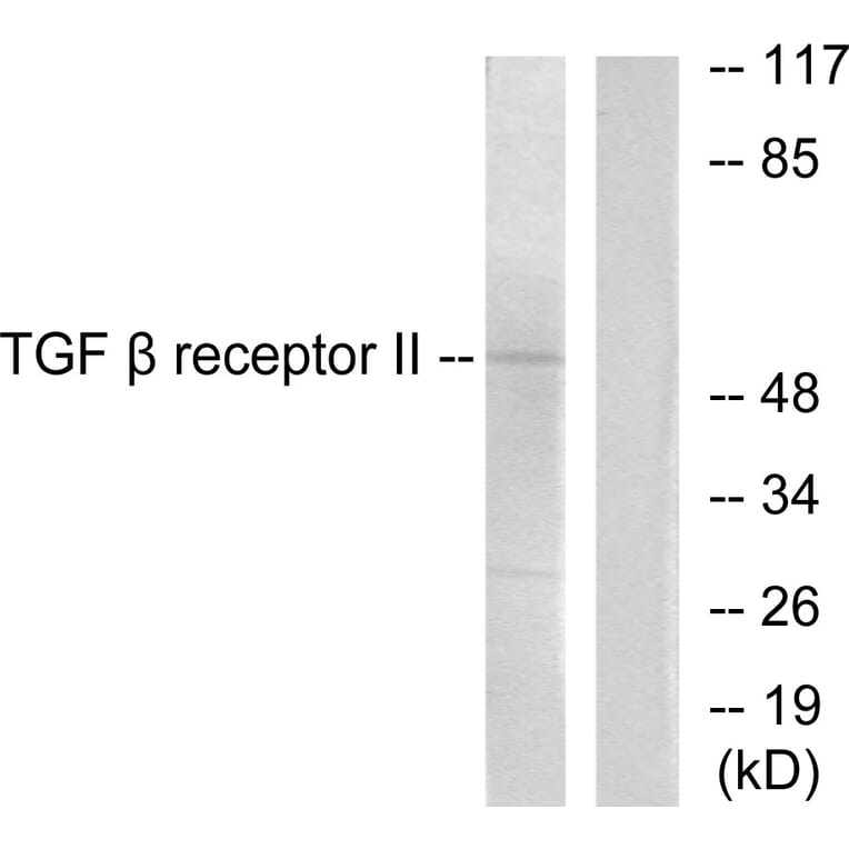 Western Blot - Anti-TGF beta Receptor II Antibody (C0338) - Antibodies.com