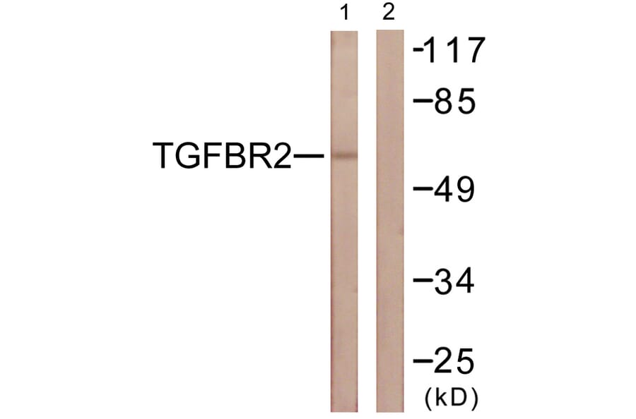 Western Blot - Anti-TGF beta Receptor II Antibody (B1127) - Antibodies.com