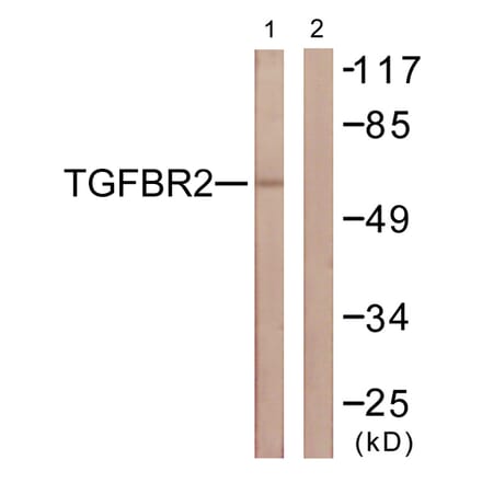 Western Blot - Anti-TGF beta Receptor II Antibody (B1127) - Antibodies.com