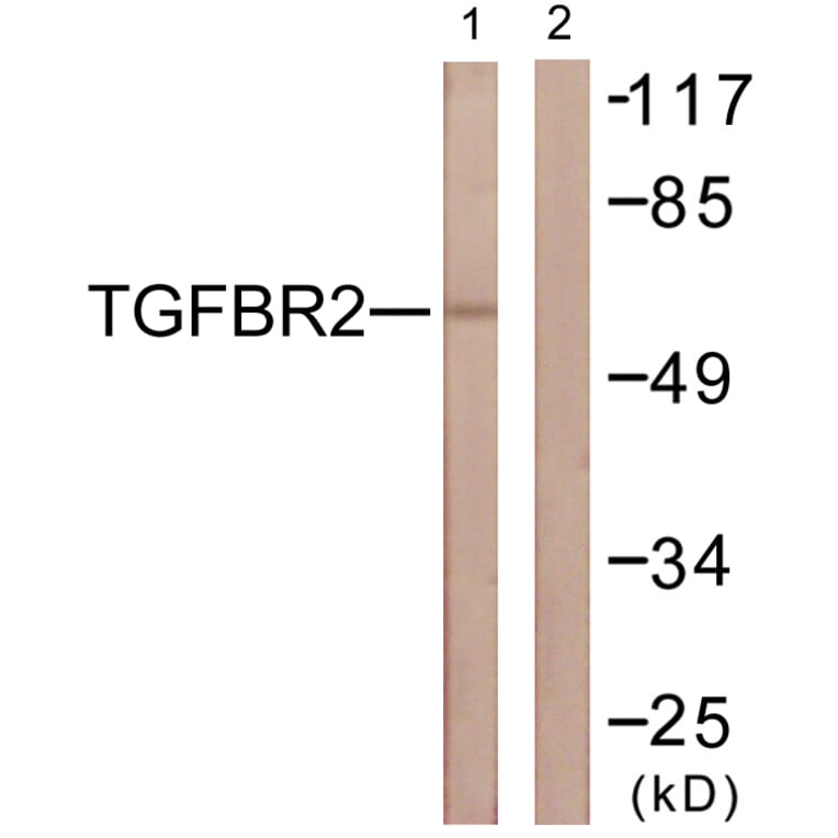 Western Blot - Anti-TGF beta Receptor II Antibody (B1127) - Antibodies.com