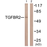 Western Blot - Anti-TGF beta Receptor II Antibody (B1127) - Antibodies.com