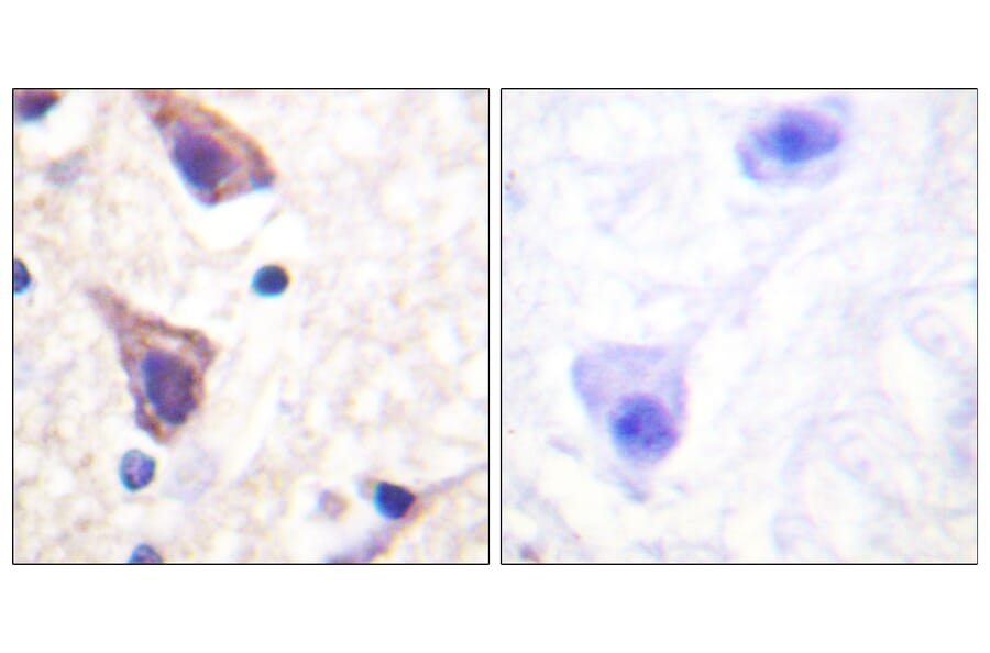 Immunohistochemistry - Anti-TGF beta Receptor II Antibody (B1127) - Antibodies.com