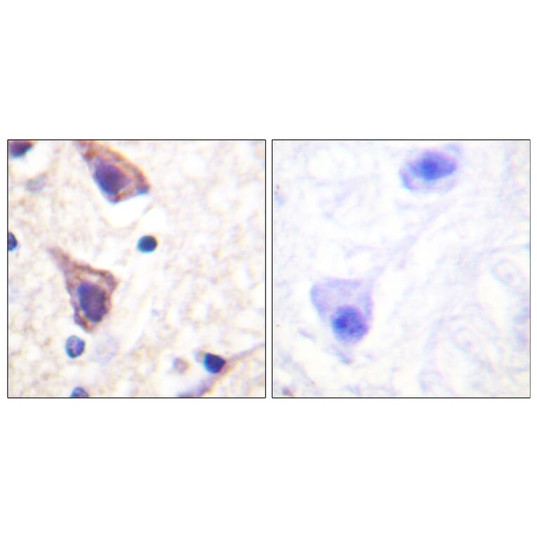 Immunohistochemistry - Anti-TGF beta Receptor II Antibody (B1127) - Antibodies.com