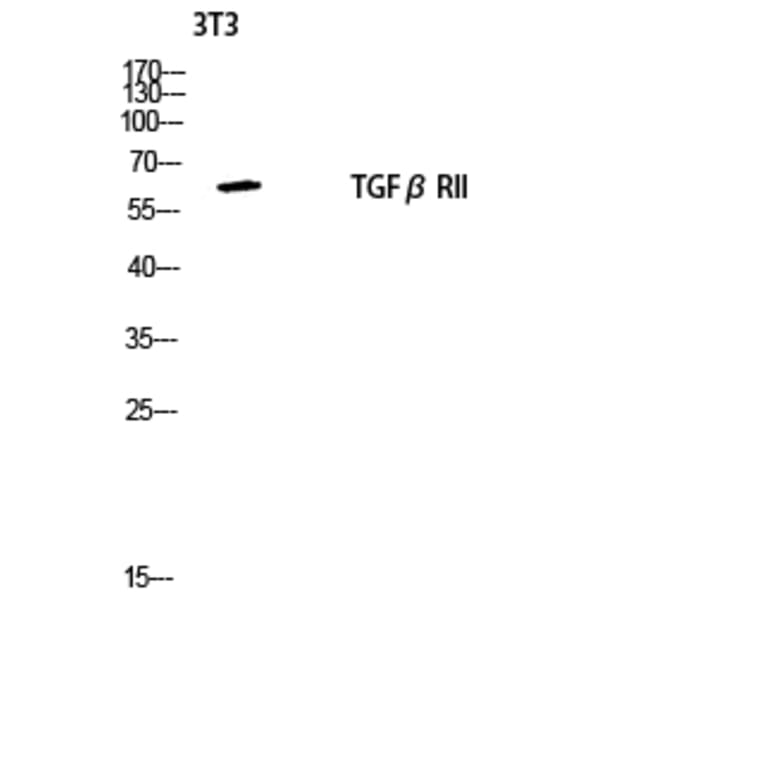 Western Blot - Anti-TGF beta Receptor II Antibody (B1127) - Antibodies.com