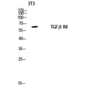 Western Blot - Anti-TGF beta Receptor II Antibody (B1127) - Antibodies.com