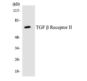 Western Blot - Anti-TGF beta Receptor II Antibody (R12-3619) - Antibodies.com