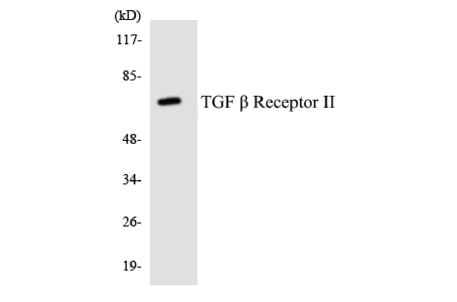 Western Blot - Anti-TGF beta Receptor II Antibody (R12-3619) - Antibodies.com