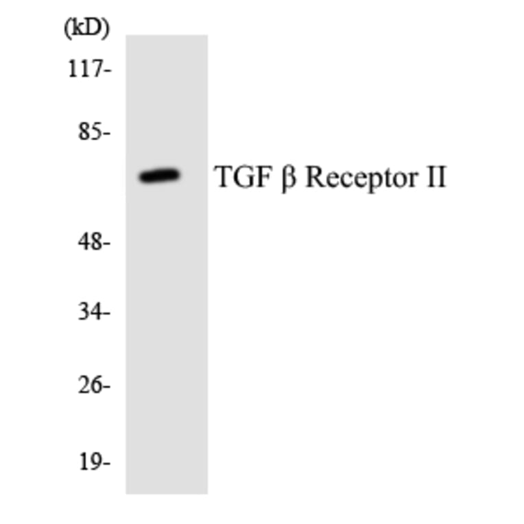 Western Blot - Anti-TGF beta Receptor II Antibody (R12-3619) - Antibodies.com