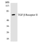 Western Blot - Anti-TGF beta Receptor II Antibody (R12-3619) - Antibodies.com