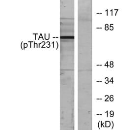 Western Blot - Anti-Tau (phospho Thr231) Antibody (A7247) - Antibodies.com