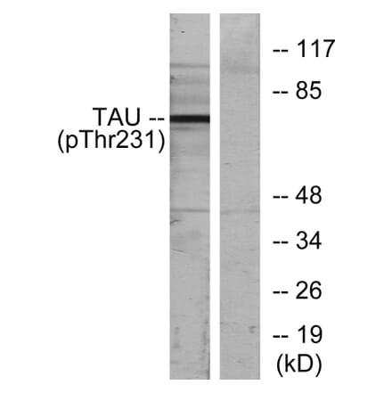 Western Blot - Anti-Tau (phospho Thr231) Antibody (A7247) - Antibodies.com