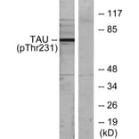 Western Blot - Anti-Tau (phospho Thr231) Antibody (A7247) - Antibodies.com