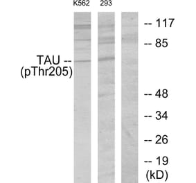 Western Blot - Anti-Tau (phospho Thr205) Antibody (A7245) - Antibodies.com