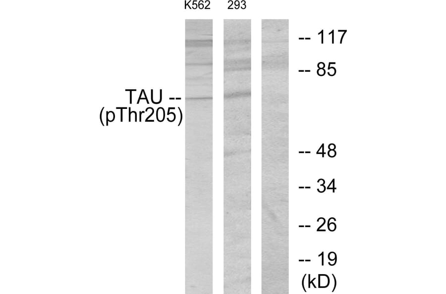 Western Blot - Anti-Tau (phospho Thr205) Antibody (A7245) - Antibodies.com
