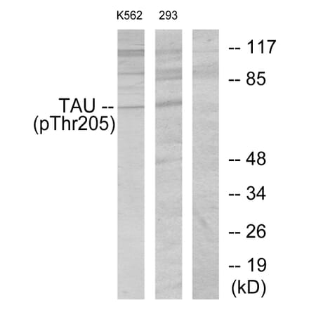 Western Blot - Anti-Tau (phospho Thr205) Antibody (A7245) - Antibodies.com