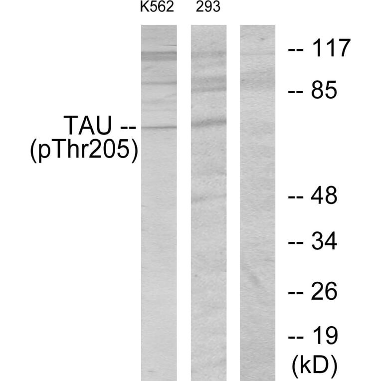 Western Blot - Anti-Tau (phospho Thr205) Antibody (A7245) - Antibodies.com