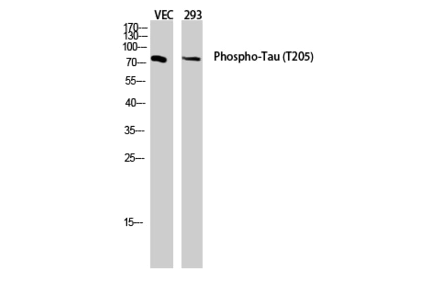 Western Blot - Anti-Tau (phospho Thr205) Antibody (A7245) - Antibodies.com