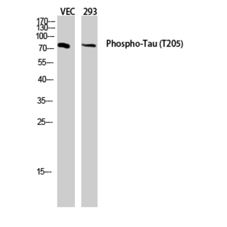 Western Blot - Anti-Tau (phospho Thr205) Antibody (A7245) - Antibodies.com