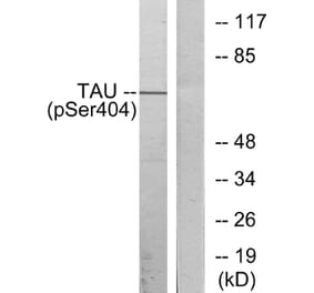 Western Blot - Anti-Tau (phospho Ser404) Antibody (A7242) - Antibodies.com