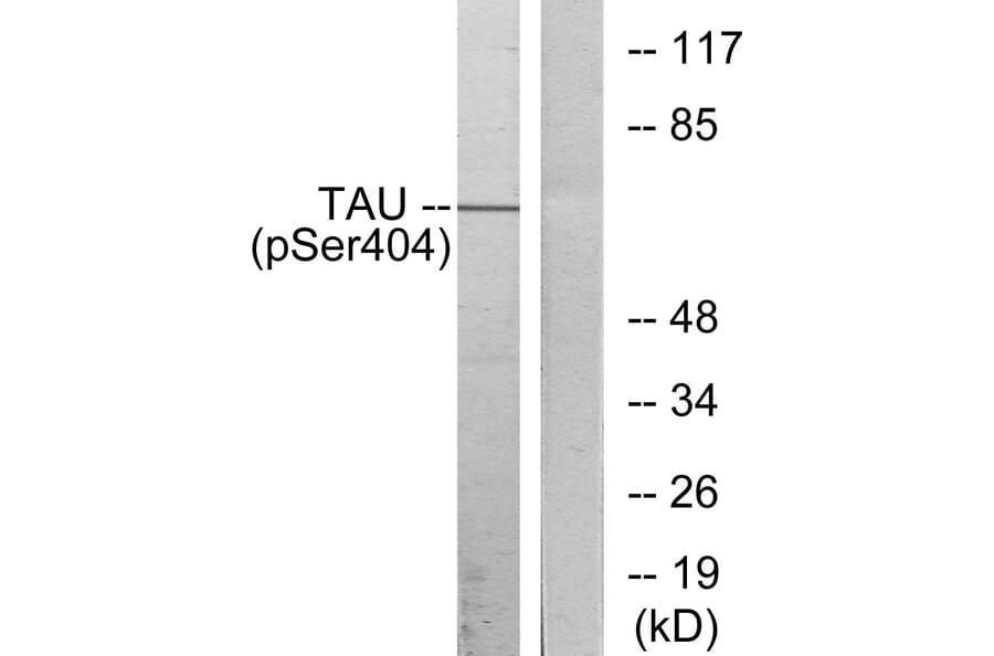 Western Blot - Anti-Tau (phospho Ser404) Antibody (A7242) - Antibodies.com