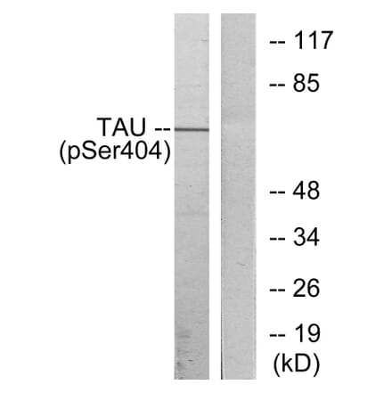 Western Blot - Anti-Tau (phospho Ser404) Antibody (A7242) - Antibodies.com