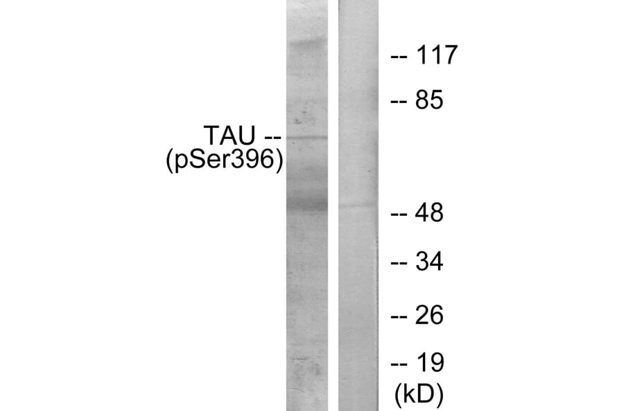 Western Blot - Anti-Tau (phospho Ser396) Antibody (A7241) - Antibodies.com