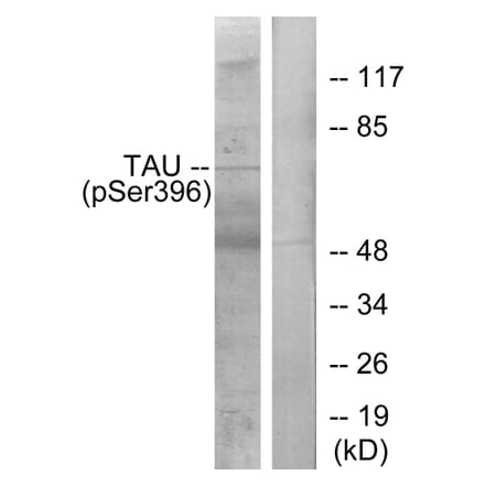 Western Blot - Anti-Tau (phospho Ser396) Antibody (A7241) - Antibodies.com