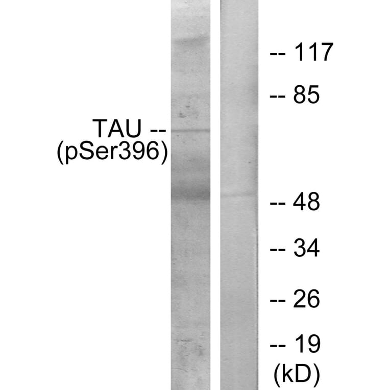 Western Blot - Anti-Tau (phospho Ser396) Antibody (A7241) - Antibodies.com