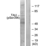 Western Blot - Anti-Tau (phospho Ser396) Antibody (A7241) - Antibodies.com