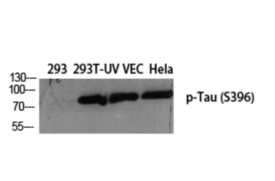 Western Blot - Anti-Tau (phospho Ser396) Antibody (A7241) - Antibodies.com