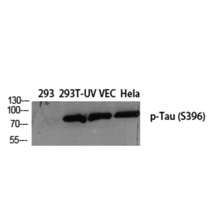 Western Blot - Anti-Tau (phospho Ser396) Antibody (A7241) - Antibodies.com