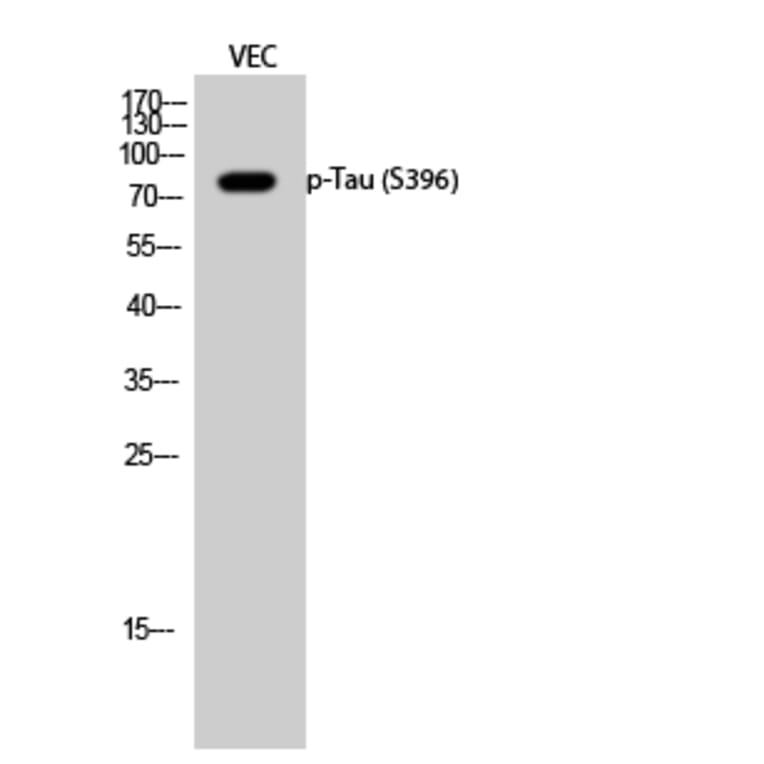 Western Blot - Anti-Tau (phospho Ser396) Antibody (A7241) - Antibodies.com