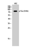 Western Blot - Anti-Tau (phospho Ser396) Antibody (A7241) - Antibodies.com