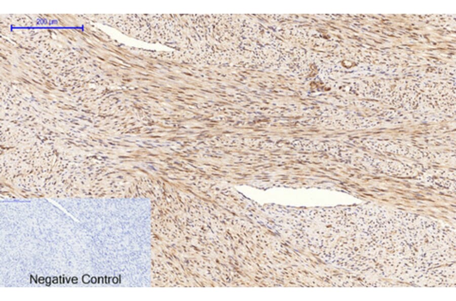Immunohistochemistry - Anti-Tau (phospho Ser396) Antibody (A7241) - Antibodies.com