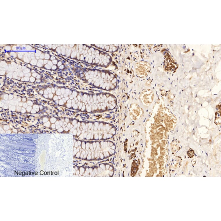 Immunohistochemistry - Anti-Tau (phospho Ser396) Antibody (A7241) - Antibodies.com