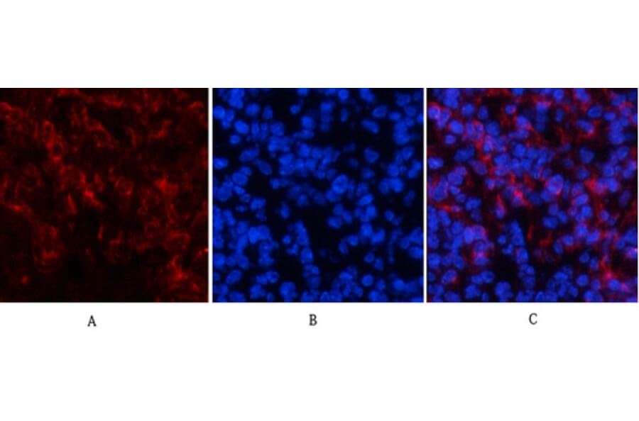 Immunofluorescence - Anti-Tau (phospho Ser396) Antibody (A7241) - Antibodies.com