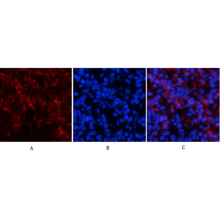 Immunofluorescence - Anti-Tau (phospho Ser396) Antibody (A7241) - Antibodies.com