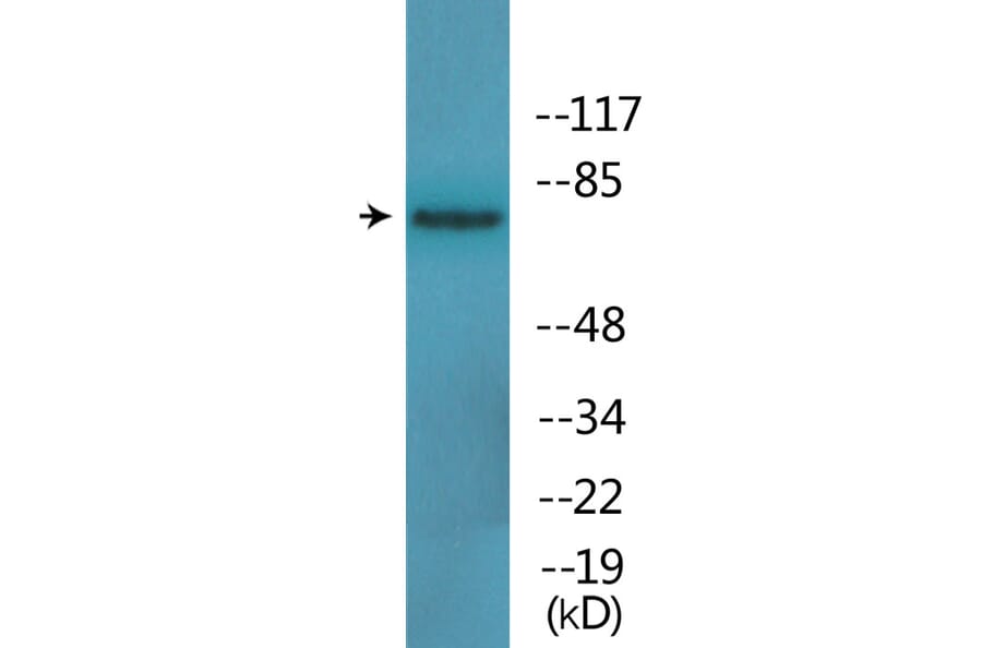 Western Blot - Anti-Tau (phospho Ser396) Antibody (P12-1188) - Antibodies.com