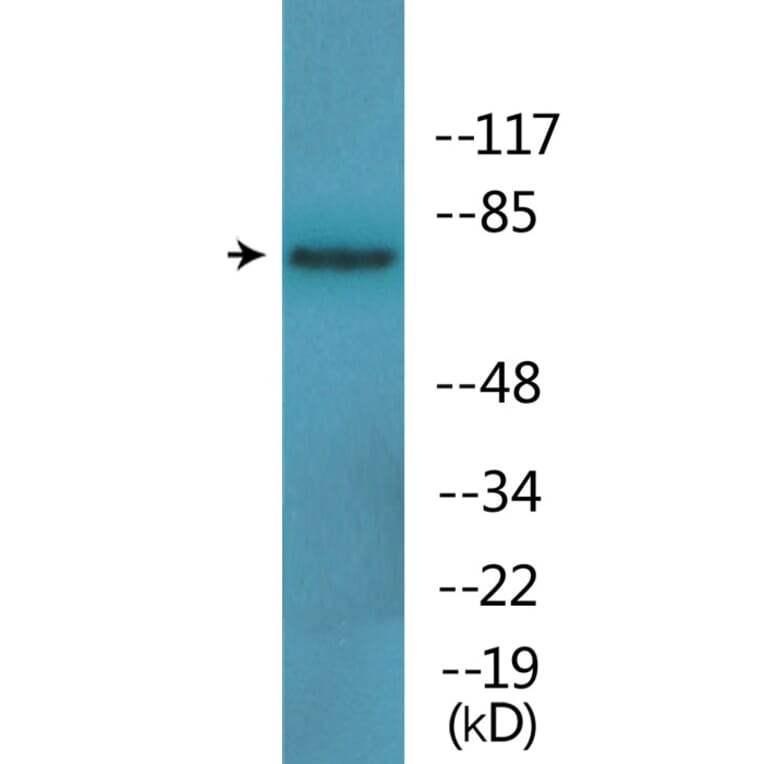 Western Blot - Anti-Tau (phospho Ser396) Antibody (P12-1188) - Antibodies.com