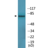 Western Blot - Anti-Tau (phospho Ser396) Antibody (P12-1188) - Antibodies.com