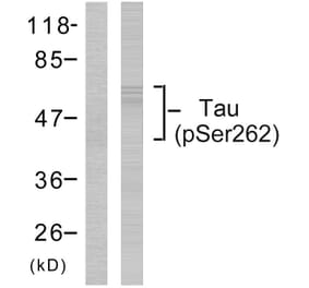 Western Blot - Anti-Tau (phospho Ser262) Antibody (A7239) - Antibodies.com