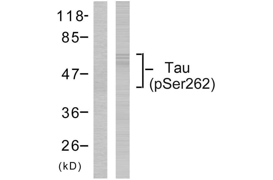 Western Blot - Anti-Tau (phospho Ser262) Antibody (A7239) - Antibodies.com