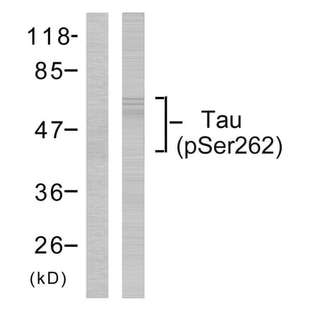 Western Blot - Anti-Tau (phospho Ser262) Antibody (A7239) - Antibodies.com