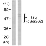 Western Blot - Anti-Tau (phospho Ser262) Antibody (A7239) - Antibodies.com