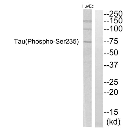 Western Blot - Anti-Tau (phospho Ser235) Antibody (A7238) - Antibodies.com