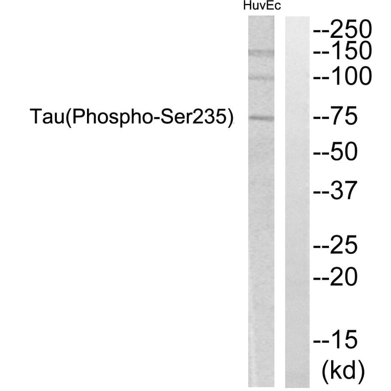 Western Blot - Anti-Tau (phospho Ser235) Antibody (A7238) - Antibodies.com
