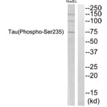 Western Blot - Anti-Tau (phospho Ser235) Antibody (A7238) - Antibodies.com