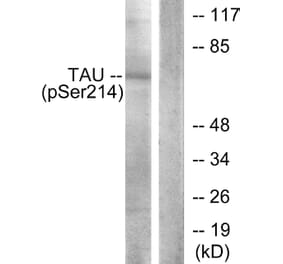 Western Blot - Anti-Tau (phospho Ser214) Antibody (A7237) - Antibodies.com