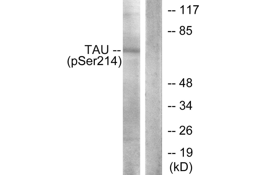 Western Blot - Anti-Tau (phospho Ser214) Antibody (A7237) - Antibodies.com